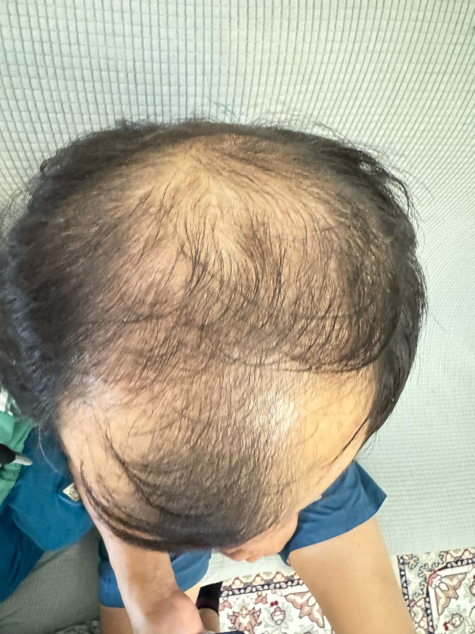 Фото до(2).jpg